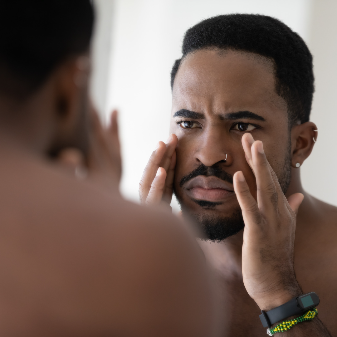 HANGOVER EYES IANC, For Men.